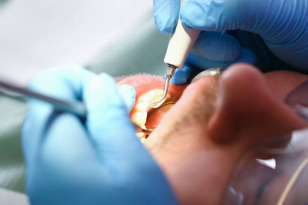 Best Emergency Gum Treatment in Gerald, MO