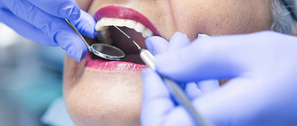 Best Emergency Treatment for Dental Infections or Abscesses in Gerald, MO