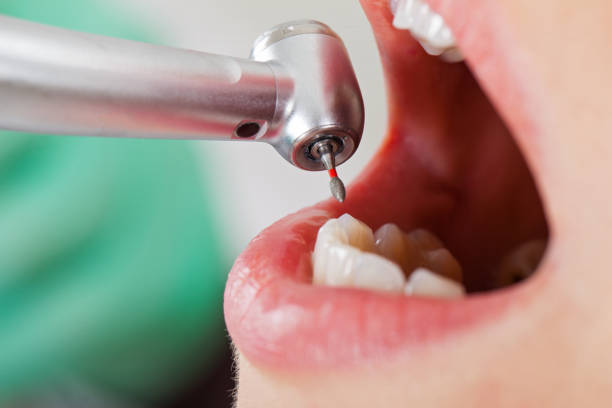 Best Urgent Care for Lost Fillings or Crowns in Gerald, MO